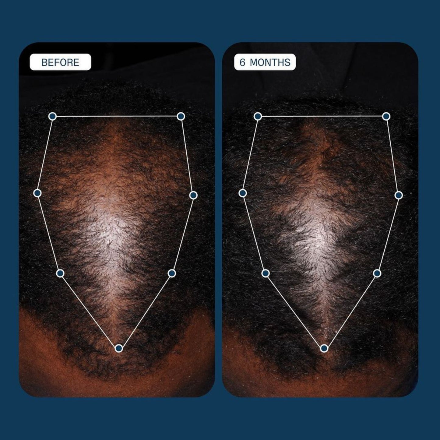 Nutrafol | Men Hair Serum